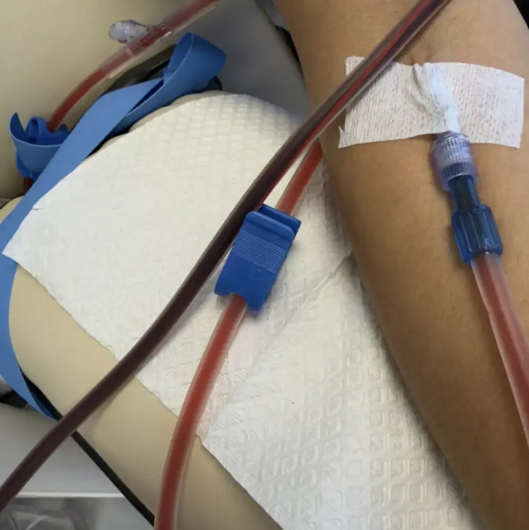 EBO3 treatment equipment in a private clinical setting.