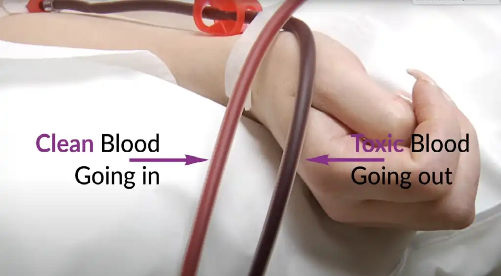 IV blood tubing